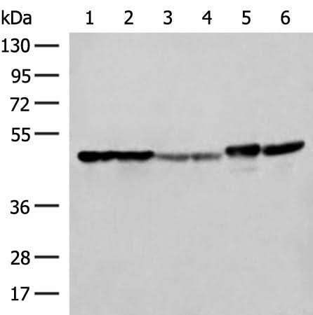 Western blot analysis of Hela A375 Human fetal liver tissue Human fetal brain tissue HepG2 cell and Mouse brain tissue lysates using FLOT2 Polyclonal Antibody at dilution of 1:350