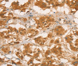 Anti-Human/Rat CPB1 Antibody - ABMIUM