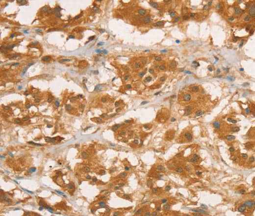 Anti-Human/Rat CPB1 Antibody