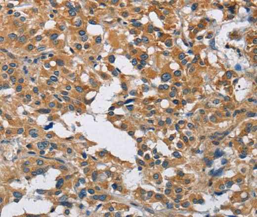 Anti-Human/Mouse/Rat DNMT3A Antibody