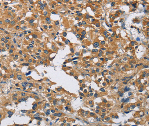 Anti-Human/Mouse/Rat DNMT3A Antibody - ABMIUM