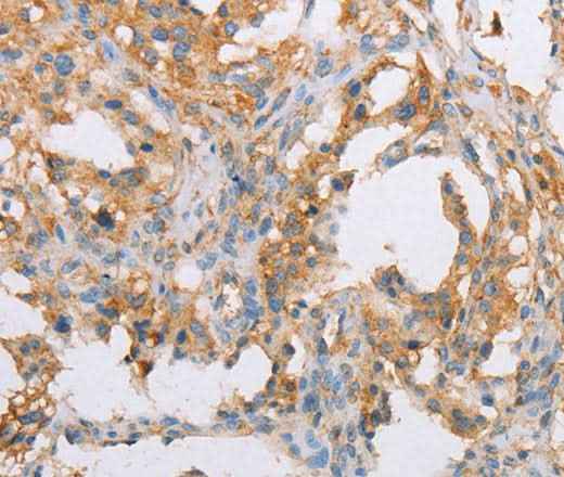 Anti-Human/Mouse/Rat ACTR2 Antibody