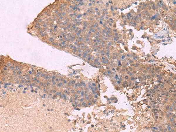 Anti-Human KCNU1 Antibody