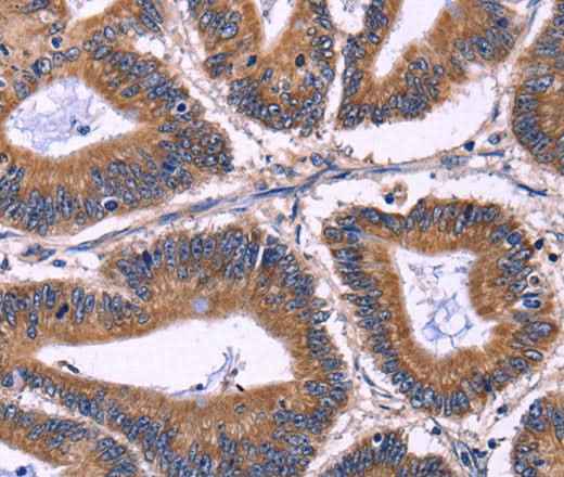 Anti-Human KIR2DL1/3/4/S4 Antibody
