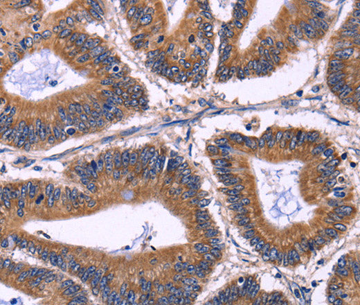 Anti-Human KIR2DL1/3/4/S4 Antibody - ABMIUM