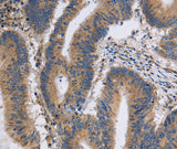 Anti-Human/Mouse/Rat ITPR1 Antibody - ABMIUM