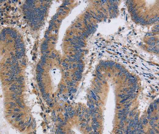 Anti-Human/Mouse/Rat ITPR1 Antibody