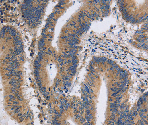 Anti-Human/Mouse/Rat ITPR1 Antibody - ABMIUM