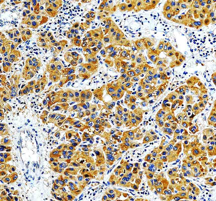Anti-CBARA1/MICU1 Antibody Picoband®
