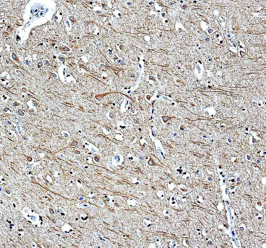 Anti-CBARA1/MICU1 Antibody Picoband®