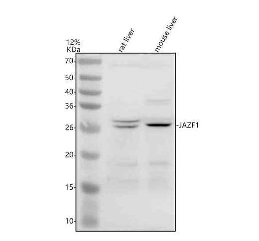 Anti-JAZF1 Antibody Picoband®