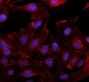 Anti-FREM2 Antibody Picoband®