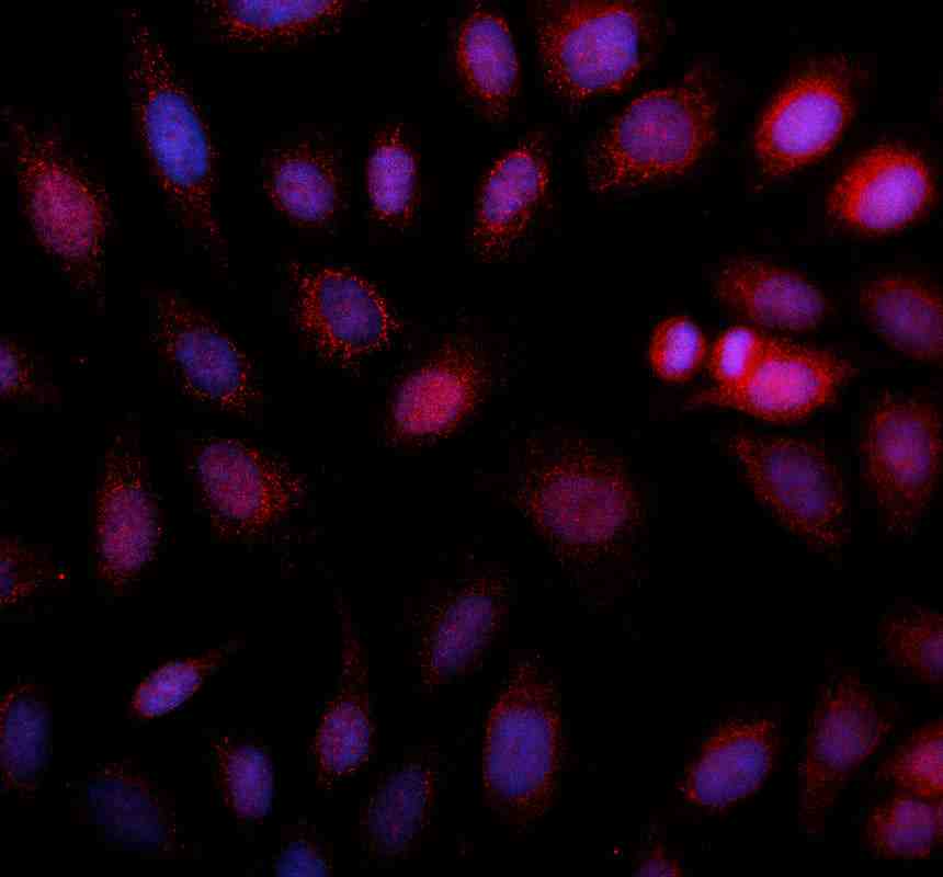 Anti-MTFMT Antibody Picoband®