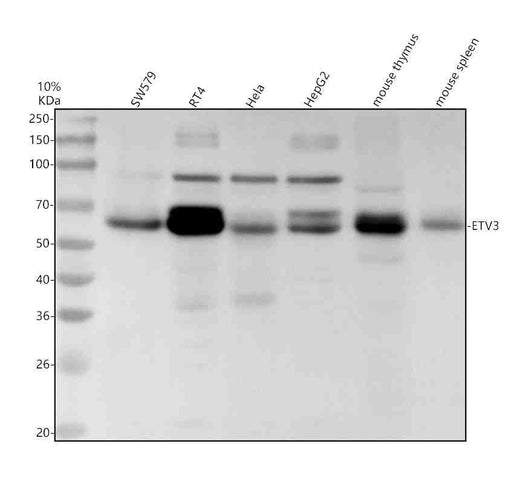 Anti-ETV3 Antibody Picoband®