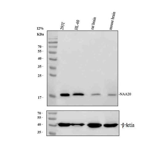 Anti-NAT5/NAA20 Antibody Picoband®