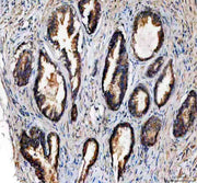 Anti-NDUFA11 Antibody Picoband®