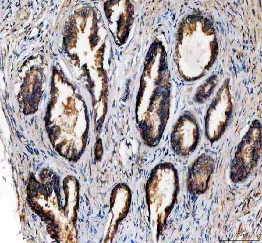Anti-NDUFA11 Antibody Picoband®
