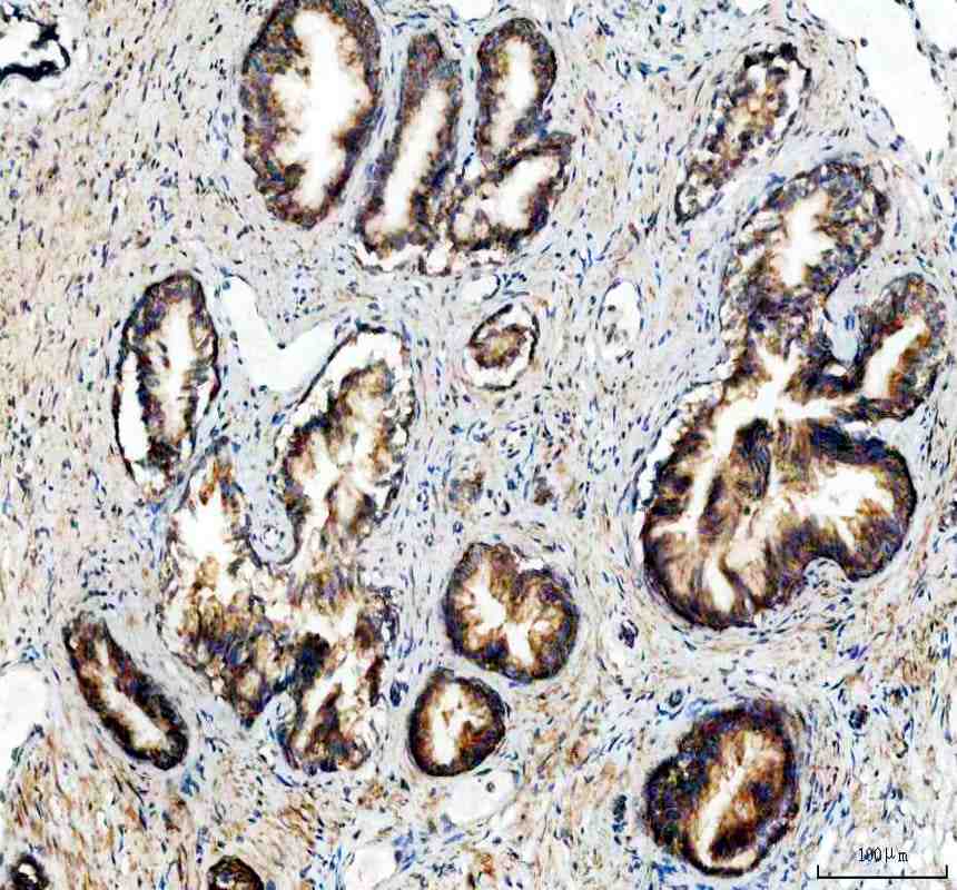 Anti-NDUFA11 Antibody Picoband®