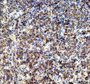 Anti-NDUFA11 Antibody Picoband®