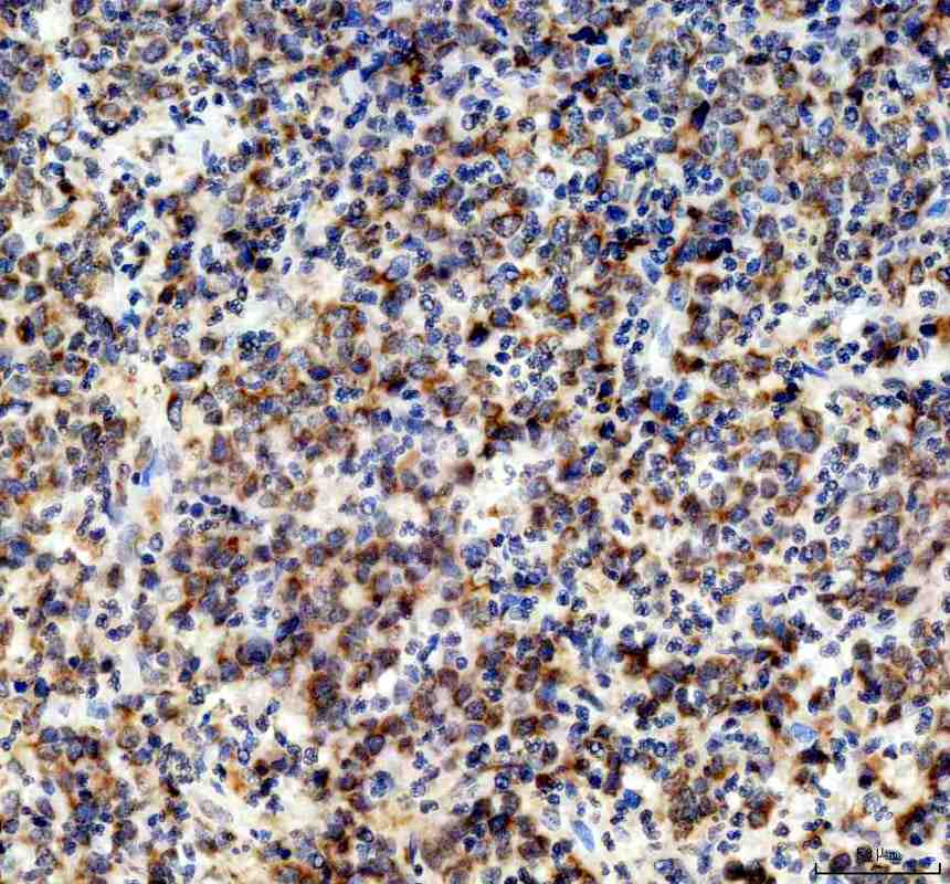 Anti-NDUFA11 Antibody Picoband®