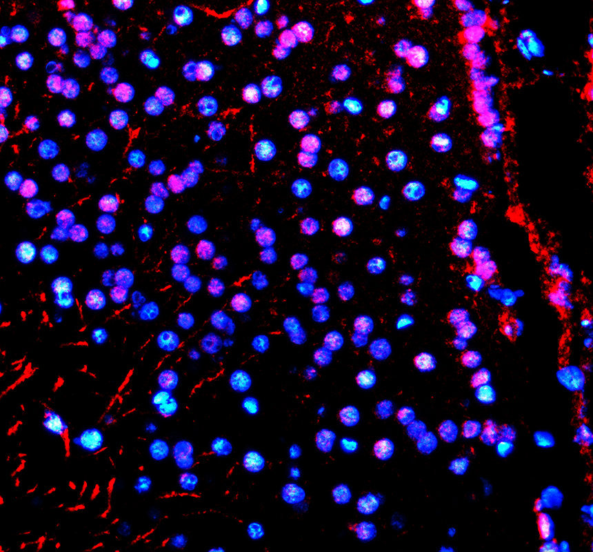 Boster AZQ66HU5 validation image 2
