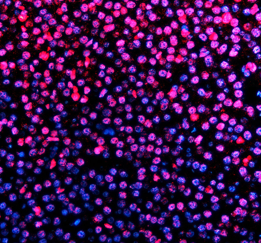 Boster AZQ66HU5 validation image 3
