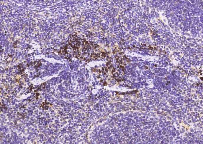 Anti-Mouse METAP2 Antibody [B458] - ABMIUM