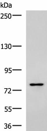 Western blot analysis of Raji cell lysate using SKI Polyclonal Antibody at dilution of 1:800