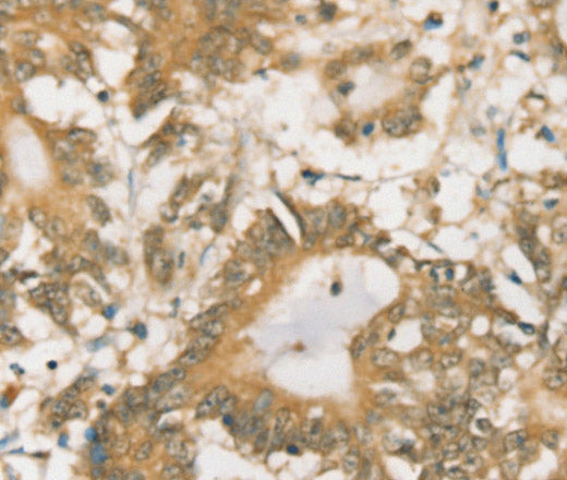 Anti-Human SIGLEC15 Antibody - ABMIUM