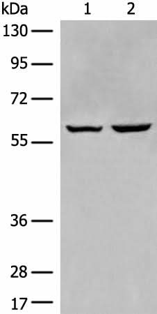 Western blot analysis of HEPG2 and Jurkat cell lysates using EBF2 Polyclonal Antibody at dilution of 1:650