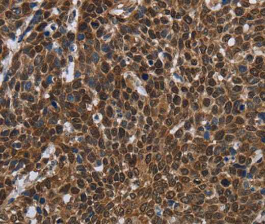 Anti-Human FASTKD2 Antibody