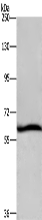 Anti-Human/Mouse DCP1A Antibody - ABMIUM