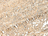 Immunohistochemistry of paraffin-embedded Human tonsil tissue using PSD4 Polyclonal Antibody at dilution of 1:50(×200)