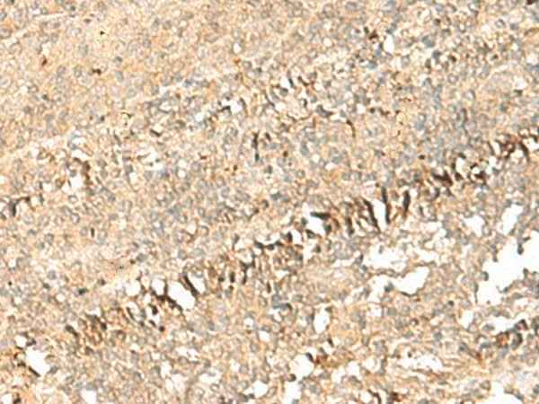 Anti-Human/Mouse PSD4 Antibody