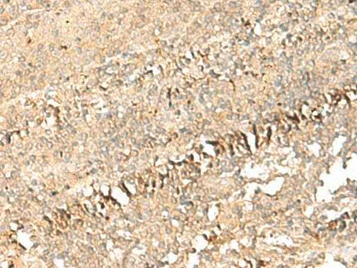 Anti-Human/Mouse PSD4 Antibody
