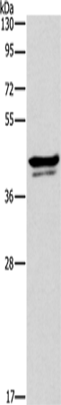 Anti-Human APOL1 Antibody - ABMIUM