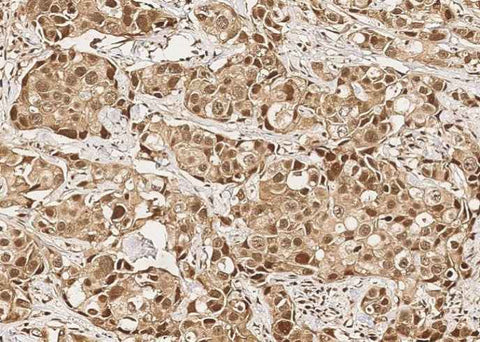 Anti-Human MCL1 Antibody [A918] - ABMIUM