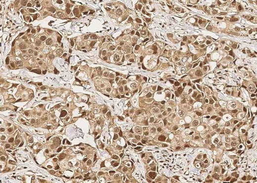 Anti-Human MCL1 Antibody [A918] - ABMIUM