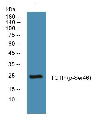 BT LAB manufacturer product image