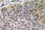Cathepsin E Polyclonal Antibody