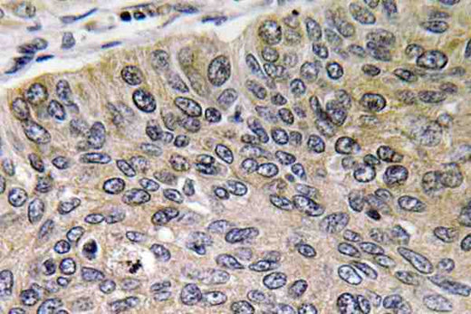 Cathepsin E Polyclonal Antibody