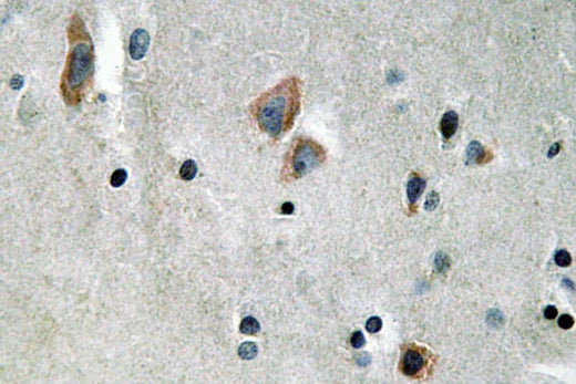 BT LAB manufacturer product image