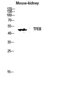 BT LAB manufacturer product image