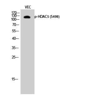 Western Blot analysis of VEC cells with Phospho-HDAC5 (Ser498) Polyclonal Antibody at dilution of 1:500