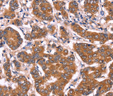 Anti-Human COL20A1 Antibody - ABMIUM