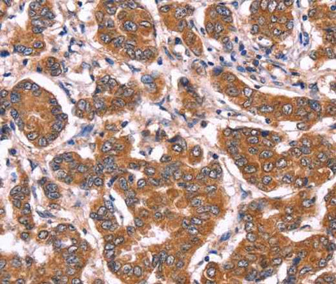 Anti-Human COL20A1 Antibody