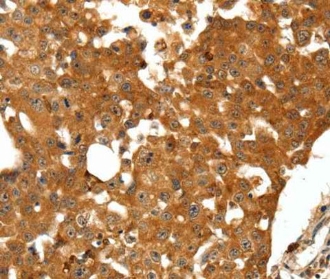 Anti-Human/Mouse/Rat SSTR1 Antibody