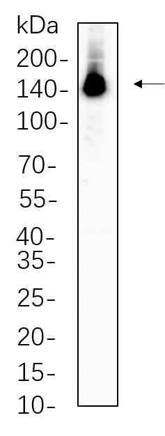 Anti-Human/Mouse/Rat ULK1 Antibody [B594] - ABMIUM