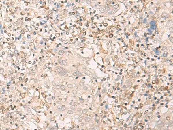 Anti-Human EPSTI1 Antibody