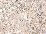 Anti-Human EPSTI1 Antibody - ABMIUM